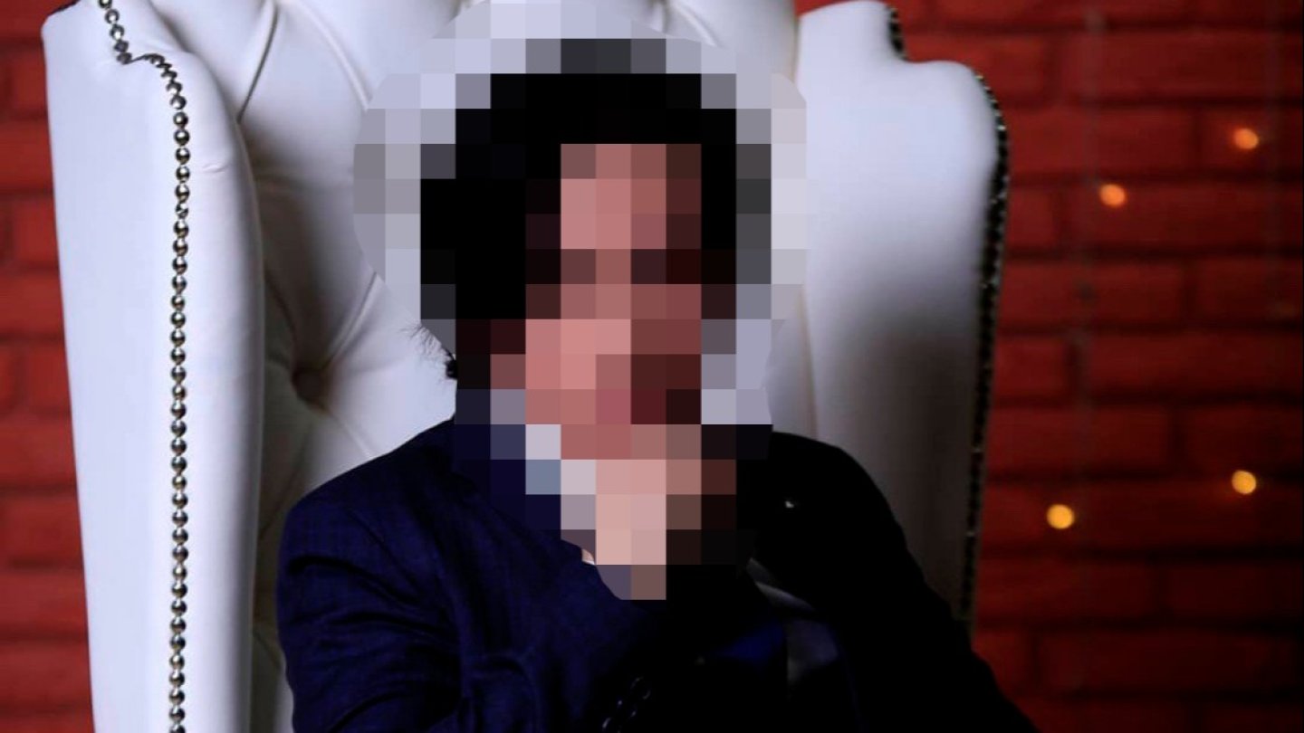 Патология жалаңаш Элис Милано